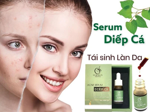 Serum diếp cá IGREEN - Giải pháp hoàn hảo cho làn da