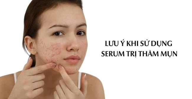 Top 10 serum trị thâm mụn tốt nhất hiệu quả sáng da nhanh chóng