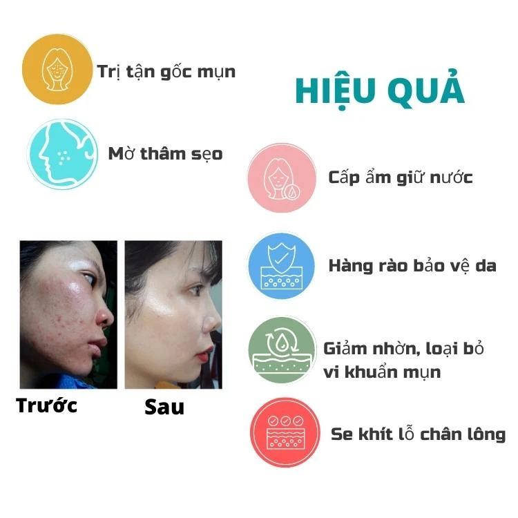 Serum trị mụn Doctorcare- trị mụn nhanh- an toàn- hiệu quả