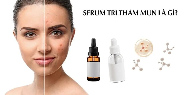 Top 10 serum trị thâm mụn tốt nhất hiệu quả sáng da nhanh chóng