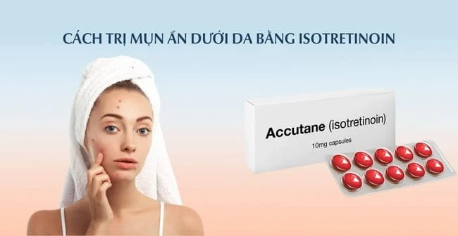 15 Cách trị mụn ẩn dưới da tại nhà an toàn hiệu quả