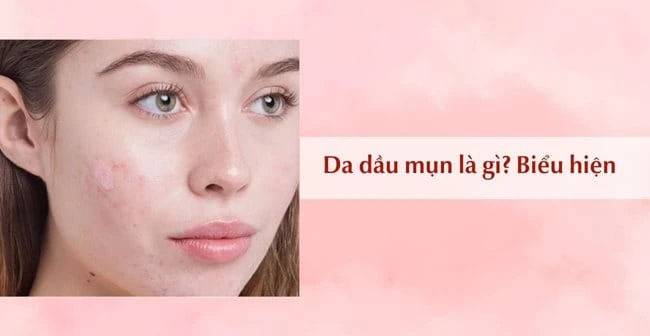 Quy Trình Các Bước Skincare Cho Da Dầu Mụn Ngày & Đêm Chuẩn