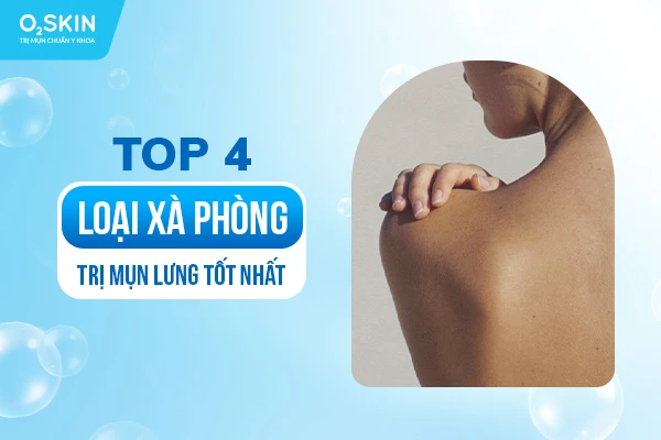 Xà phòng trị mụn lưng hiệu quả cho làn da sạch sẽ