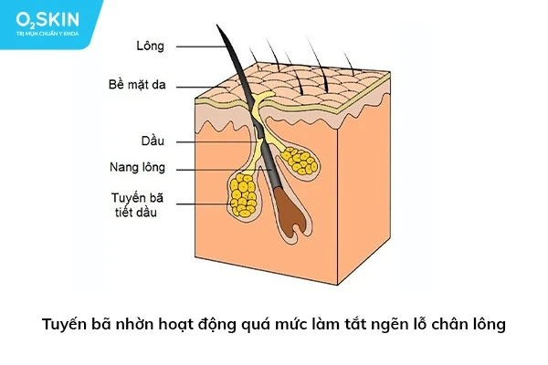 Top 4 loại xà phòng trị mụn lưng tốt nhất